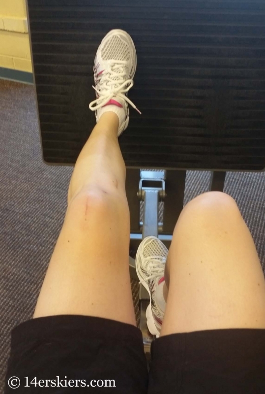 Leg press after knee surgery.